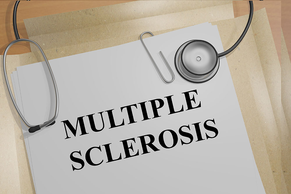 How to Stop Multiple Sclerosis From Getting Worse