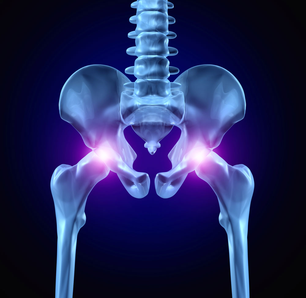 After Hip Replacement- Sitting Safely