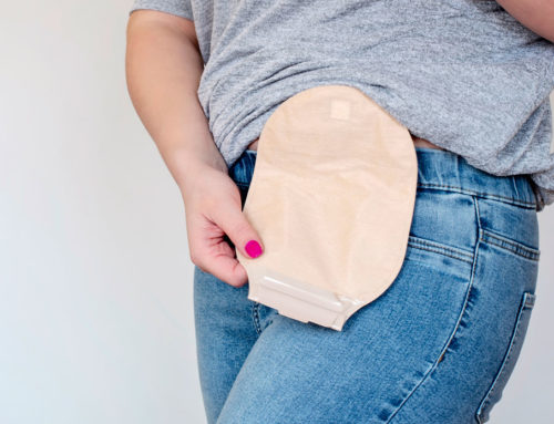 Watch For These Most Common Complications of An Ileostomy