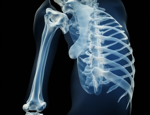 Most Common Complications of a Humerus Fracture