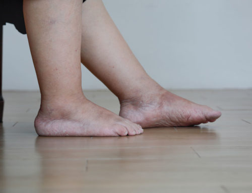 Diabetic Neuropathy: 2 Warning Signs to Watch For