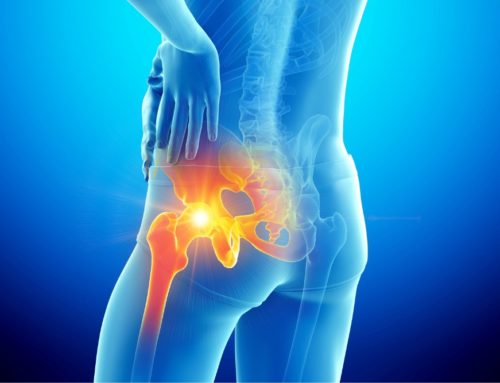 Could Your Lifestyle Be Causing Your Hip Pain